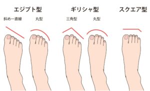 【プロフィール】 足 の 形 ギリシャ 型 気になる噂と真相 #617