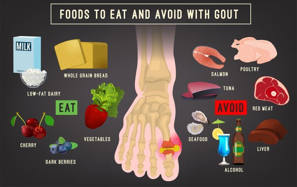 If You Have Gout What Should You Not Eat