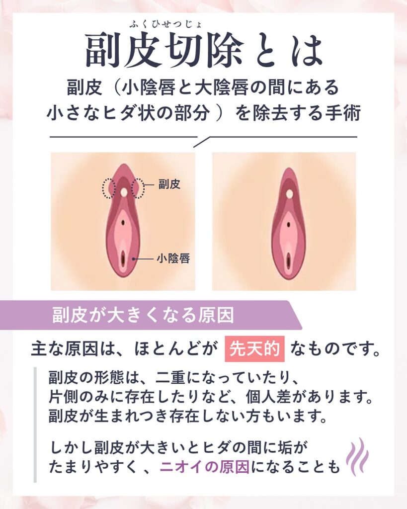 びらびらとはどの部位？小陰唇の役割・平均サイズと黒ずみの真相