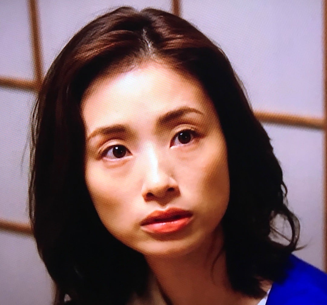目のくぼみが激変した芸能人は誰？原因と最新改善法を徹底解説